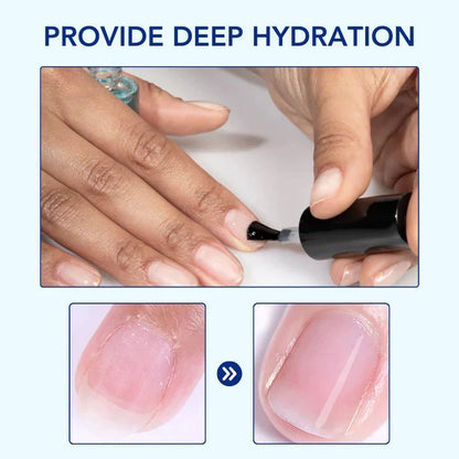 OnyxoGuard Nail Growth and Repair Serum