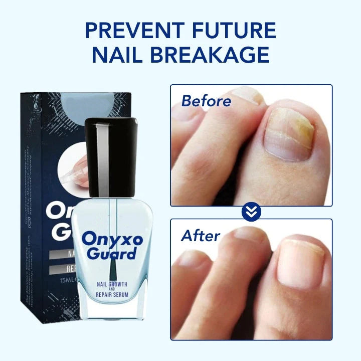 OnyxoGuard Nail Growth and Repair Serum