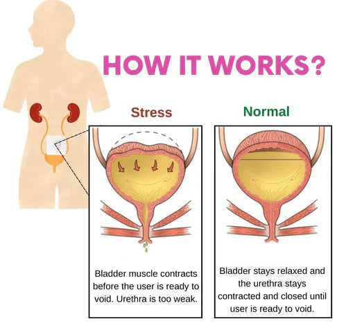 Bladder Control Patch