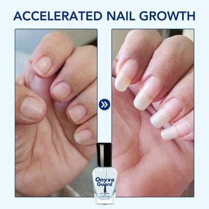 OnyxoGuard Nail Growth and Repair Serum